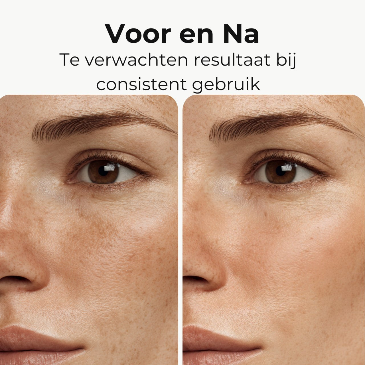 Skinlight Radiance Duo — Meest gekozen