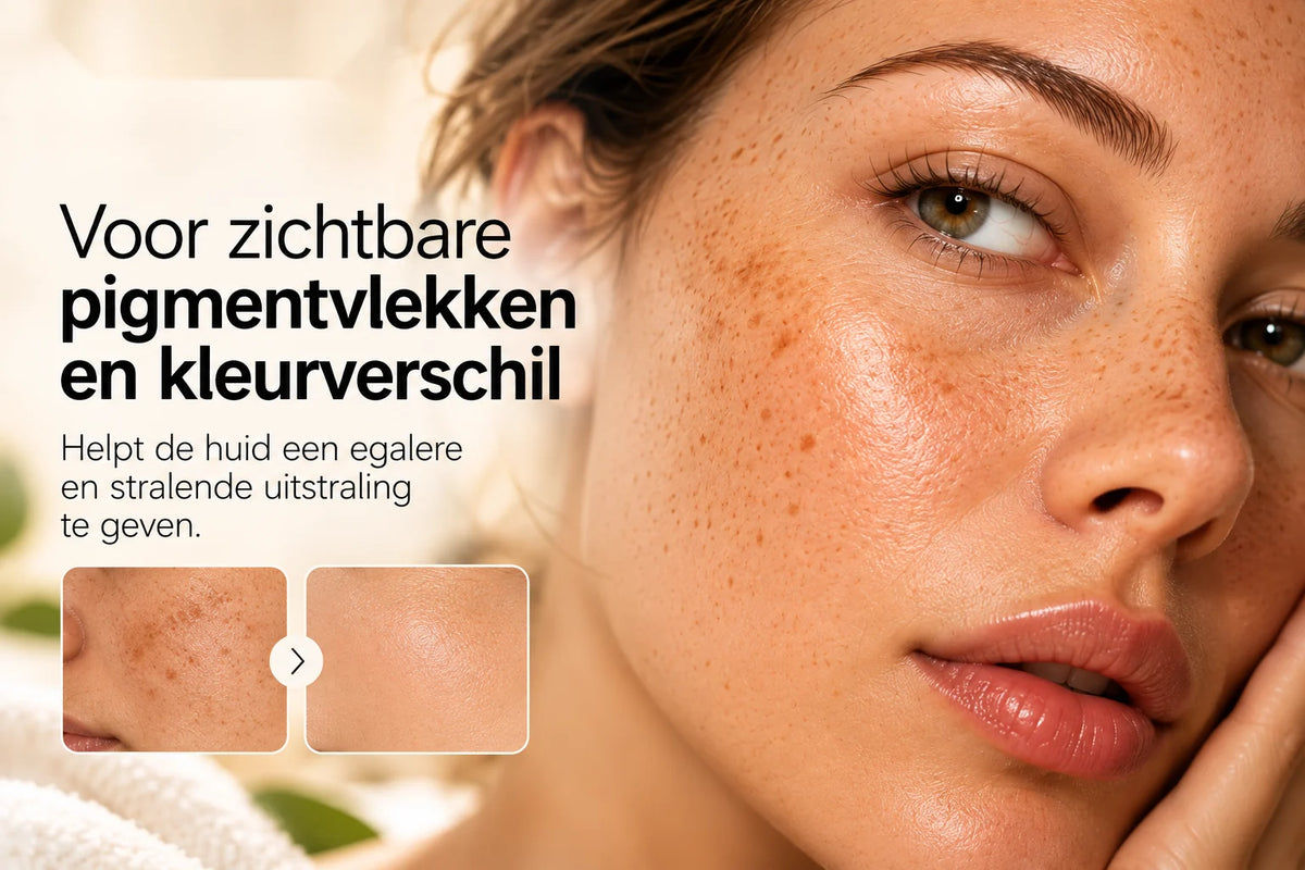 Aanvullende informatie over Skinlight